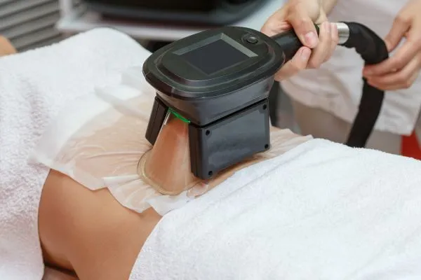 Image of person having fat freezing treatment to help weight gain Peak Dale