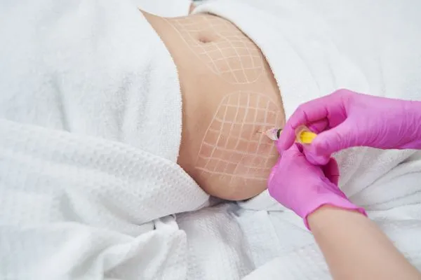 image of fat dissolving injections on love handles to help combat weight gain Peak Dale